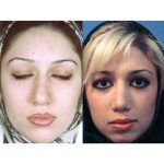 Nose shaper - Image 5
