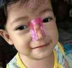 Nose shaper - Image 2
